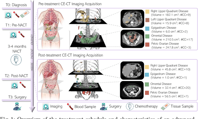 Figure 1 for A Self-Supervised Image Registration Approach for Measuring Local Response Patterns in Metastatic Ovarian Cancer