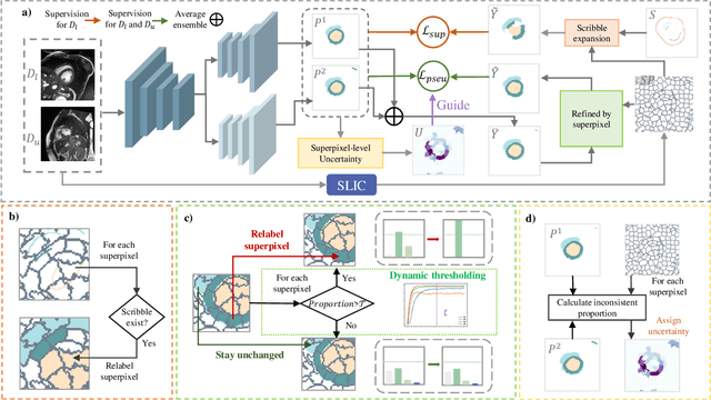 Figure 2 for SP${ }^3$ : Superpixel-propagated pseudo-label learning for weakly semi-supervised medical image segmentation