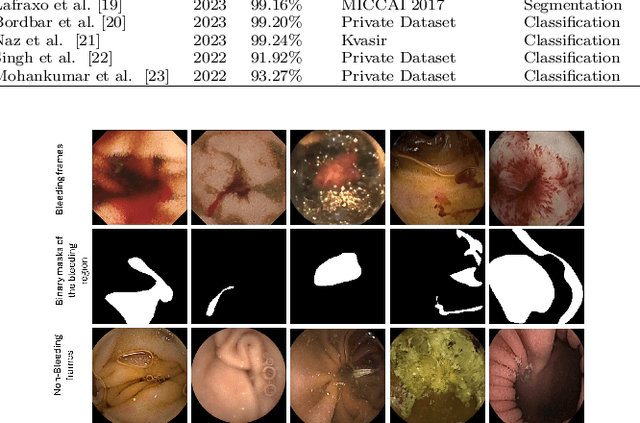 Figure 1 for WCEbleedGen: A wireless capsule endoscopy dataset and its benchmarking for automatic bleeding classification, detection, and segmentation