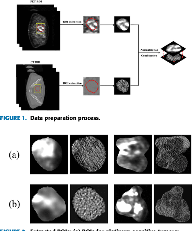 Figure 1 for An attention-based deep learning network for predicting Platinum resistance in ovarian cancer