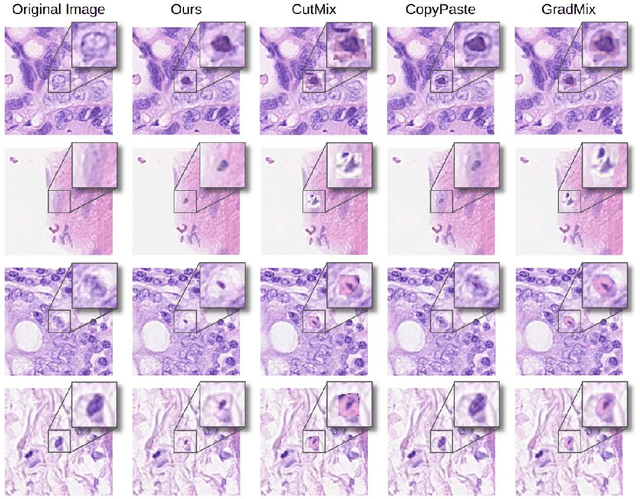 Figure 1 for NucleiMix: Realistic Data Augmentation for Nuclei Instance Segmentation