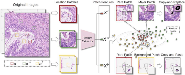 Figure 3 for NucleiMix: Realistic Data Augmentation for Nuclei Instance Segmentation