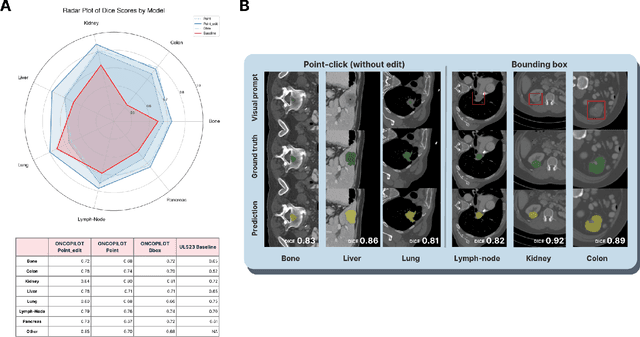 Figure 2 for ONCOPILOT: A Promptable CT Foundation Model For Solid Tumor Evaluation