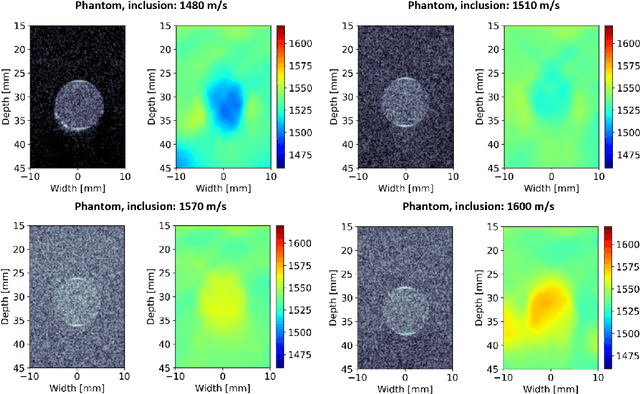 Figure 2 for Implicit Neural Representations for Speed-of-Sound Estimation in Ultrasound