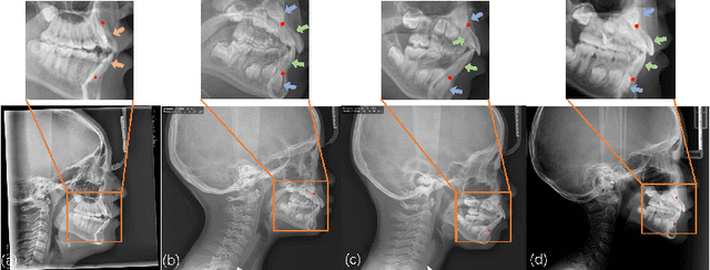 Figure 1 for Cephalometric Landmark Detection across Ages with Prototypical Network