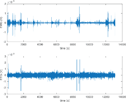 Figure 1 for sDREAMER: Self-distilled Mixture-of-Modality-Experts Transformer for Automatic Sleep Staging
