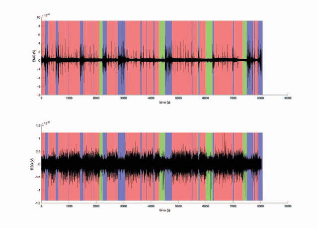 Figure 4 for sDREAMER: Self-distilled Mixture-of-Modality-Experts Transformer for Automatic Sleep Staging