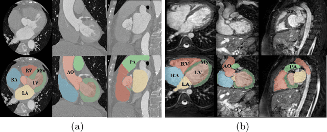 Figure 1 for Preserving Cardiac Integrity: A Topology-Infused Approach to Whole Heart Segmentation