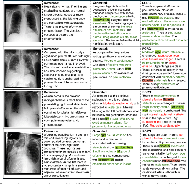 Figure 3 for Anatomy-Guided Radiology Report Generation with Pathology-Aware Regional Prompts