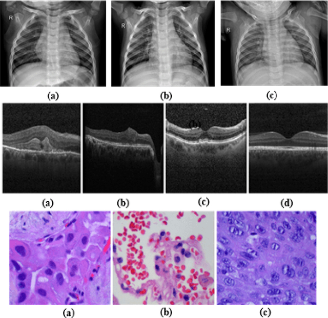 Figure 2 for Disease Classification and Impact of Pretrained Deep Convolution Neural Networks on Diverse Medical Imaging Datasets across Imaging Modalities