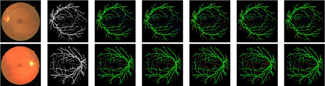 Figure 3 for Feature Enhancer Segmentation Network (FES-Net) for Vessel Segmentation