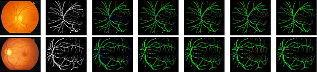 Figure 4 for Feature Enhancer Segmentation Network (FES-Net) for Vessel Segmentation