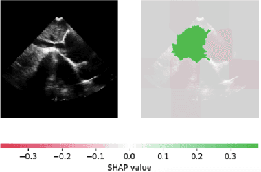 Figure 2 for Decision-based AI Visual Navigation for Cardiac Ultrasounds