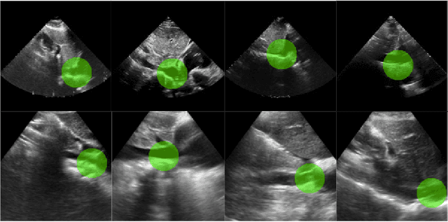 Figure 3 for Decision-based AI Visual Navigation for Cardiac Ultrasounds
