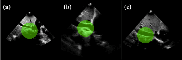 Figure 4 for Decision-based AI Visual Navigation for Cardiac Ultrasounds