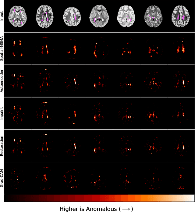 Figure 3 for Localizing Anomalies via Multiscale Score Matching Analysis