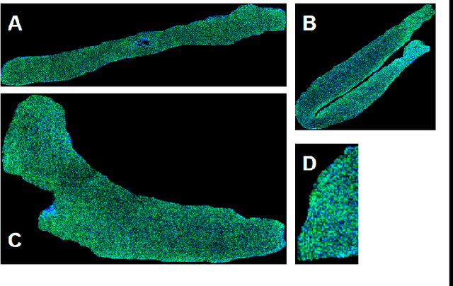 Figure 4 for NCL-SM: A Fully Annotated Dataset of Images from Human Skeletal Muscle Biopsies