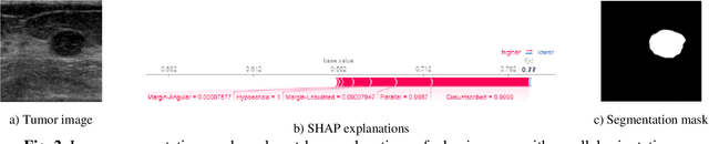 Figure 2 for Post-Hoc Explainability of BI-RADS Descriptors in a Multi-task Framework for Breast Cancer Detection and Segmentation