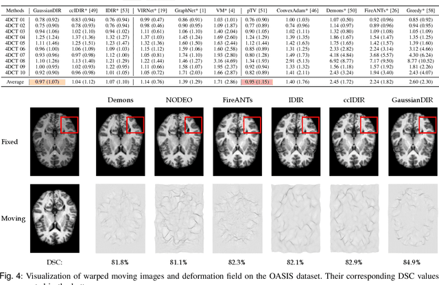 Figure 4 for Gaussian Representation for Deformable Image Registration