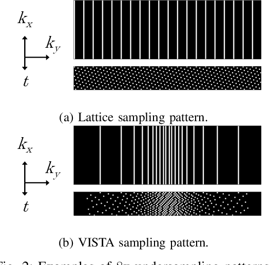 Figure 2 for DCRA-Net: Attention-Enabled Reconstruction Model for Dynamic Fetal Cardiac MRI