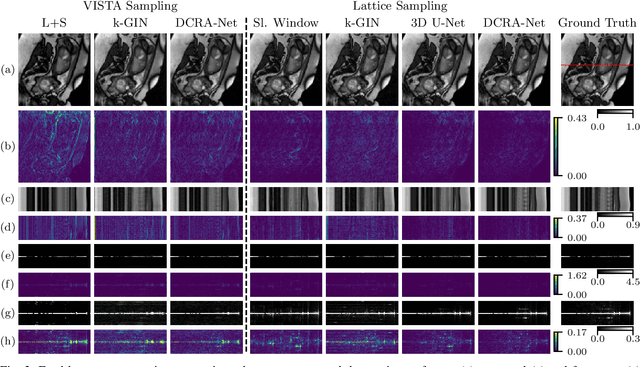 Figure 3 for DCRA-Net: Attention-Enabled Reconstruction Model for Dynamic Fetal Cardiac MRI