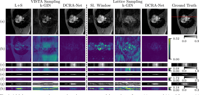 Figure 4 for DCRA-Net: Attention-Enabled Reconstruction Model for Dynamic Fetal Cardiac MRI