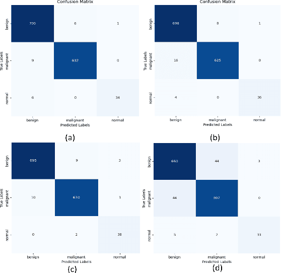 Figure 3 for Early Detection and Classification of Breast Cancer Using Deep Learning Techniques