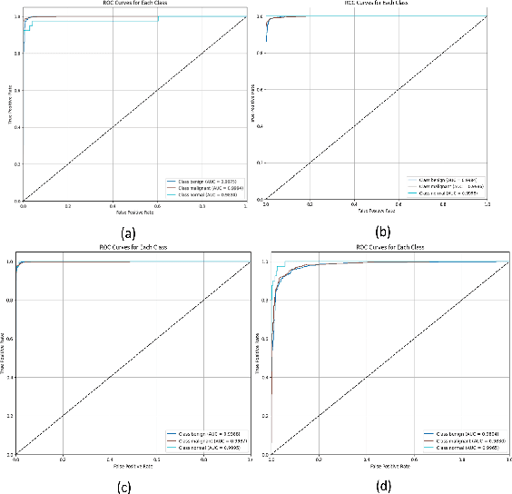 Figure 4 for Early Detection and Classification of Breast Cancer Using Deep Learning Techniques