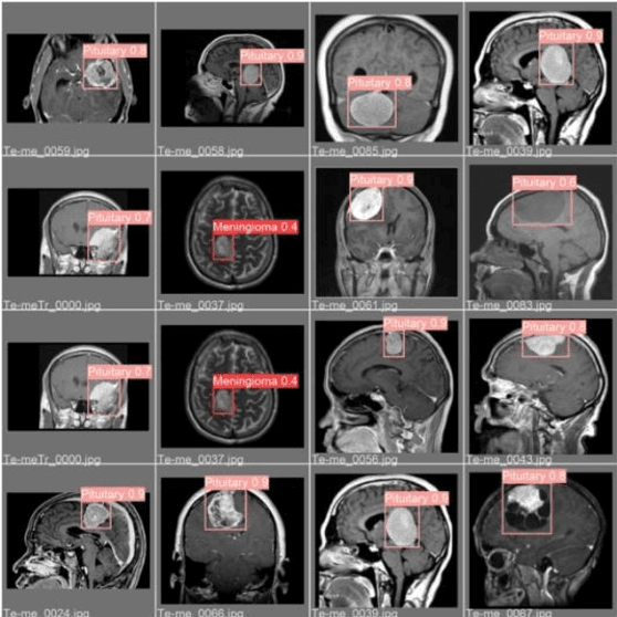 Figure 3 for Brain Cancer Segmentation Using YOLOv5 Deep Neural Network