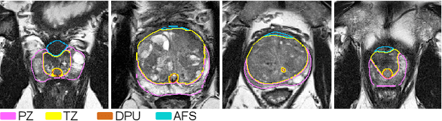 Figure 1 for PI-RADS v2 Compliant Automated Segmentation of Prostate Zones Using co-training Motivated Multi-task Dual-Path CNN