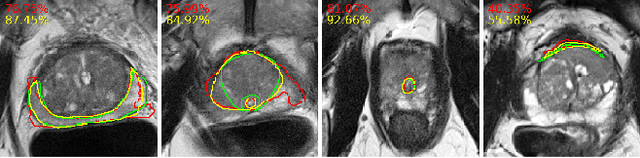 Figure 4 for PI-RADS v2 Compliant Automated Segmentation of Prostate Zones Using co-training Motivated Multi-task Dual-Path CNN