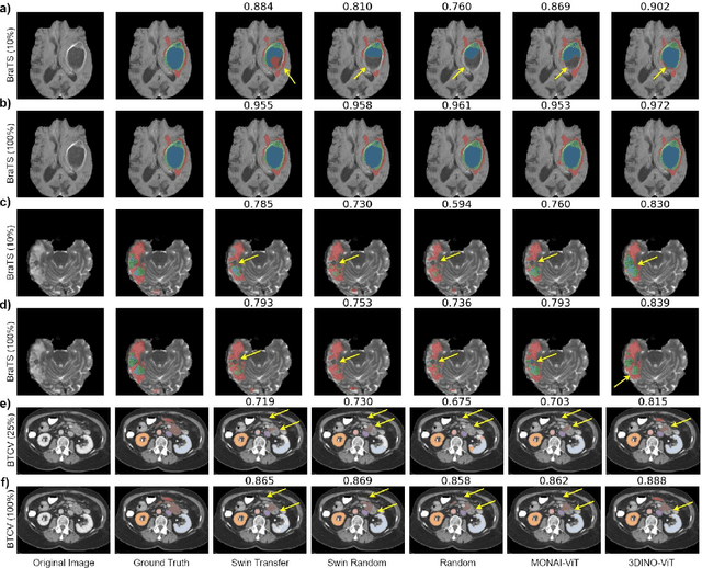 Figure 3 for A generalizable 3D framework and model for self-supervised learning in medical imaging