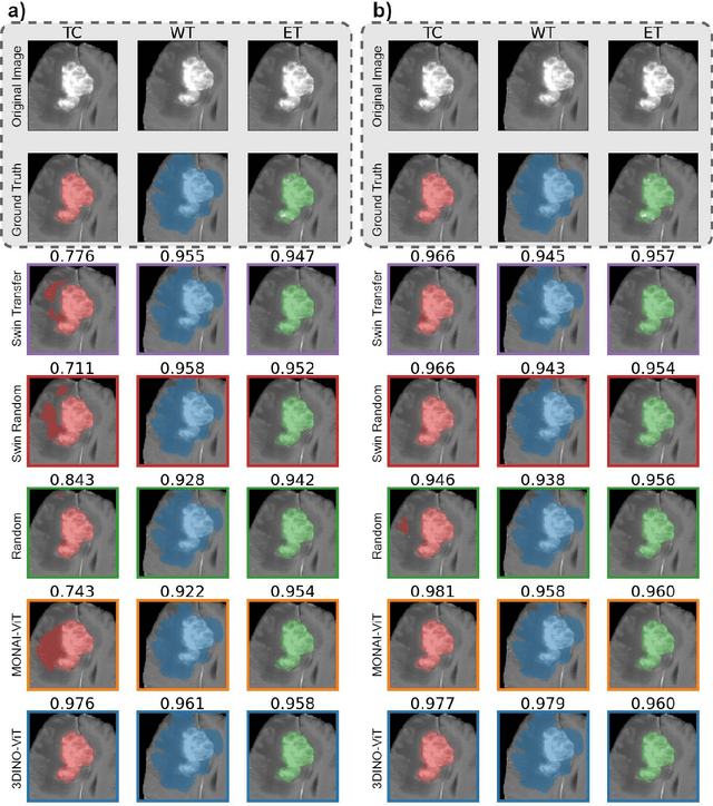 Figure 4 for A generalizable 3D framework and model for self-supervised learning in medical imaging