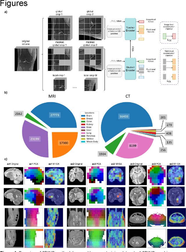 Figure 1 for A generalizable 3D framework and model for self-supervised learning in medical imaging