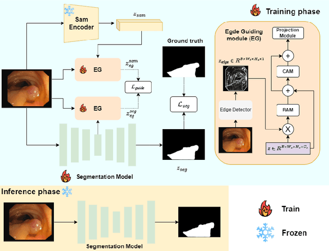 Figure 1 for SAM-EG: Segment Anything Model with Egde Guidance framework for efficient Polyp Segmentation