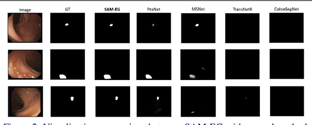 Figure 4 for SAM-EG: Segment Anything Model with Egde Guidance framework for efficient Polyp Segmentation