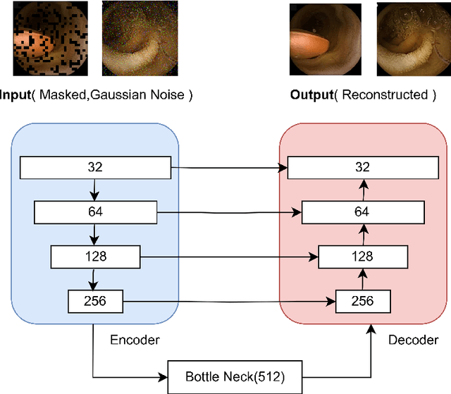 Figure 3 for Exploring Self-Supervised Learning with U-Net Masked Autoencoders and EfficientNet B7 for Improved Classification