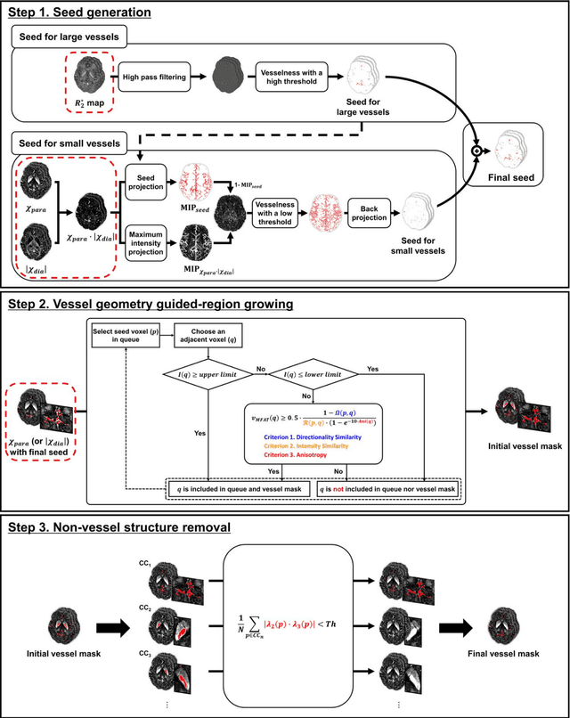 Figure 1 for Vessel segmentation for X-separation