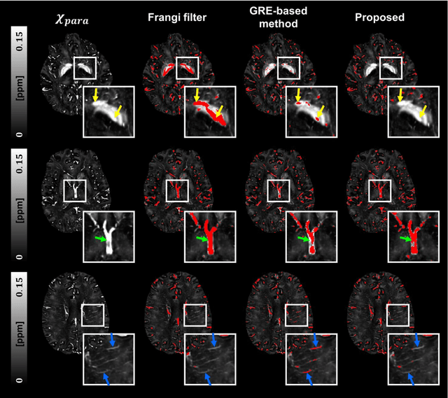 Figure 3 for Vessel segmentation for X-separation