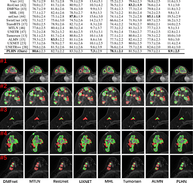 Figure 3 for Prototype Learning Guided Hybrid Network for Breast Tumor Segmentation in DCE-MRI