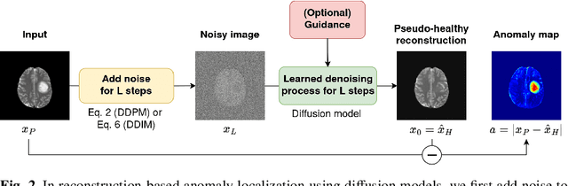 Figure 3 for Denoising Diffusion Models for Anomaly Localization in Medical Images