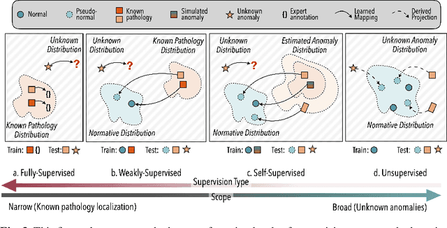 Figure 4 for Denoising Diffusion Models for Anomaly Localization in Medical Images