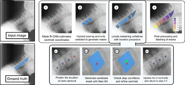 Figure 3 for SpineFM: Leveraging Foundation Models for Automatic Spine X-ray Segmentation