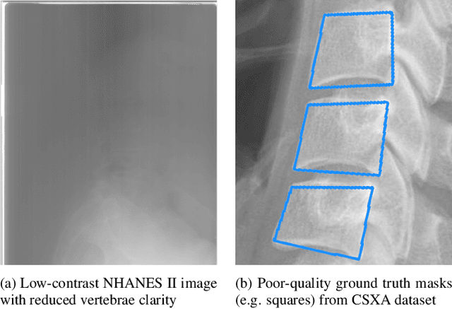 Figure 4 for SpineFM: Leveraging Foundation Models for Automatic Spine X-ray Segmentation