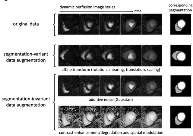 Figure 3 for Improved Robustness for Deep Learning-based Segmentation of Multi-Center Myocardial Perfusion MRI Datasets Using Data Adaptive Uncertainty-guided Space-time Analysis