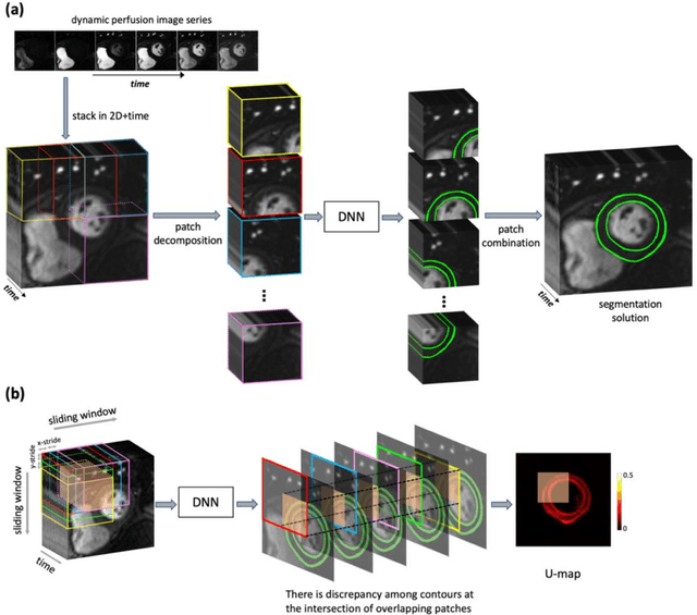 Figure 4 for Improved Robustness for Deep Learning-based Segmentation of Multi-Center Myocardial Perfusion MRI Datasets Using Data Adaptive Uncertainty-guided Space-time Analysis