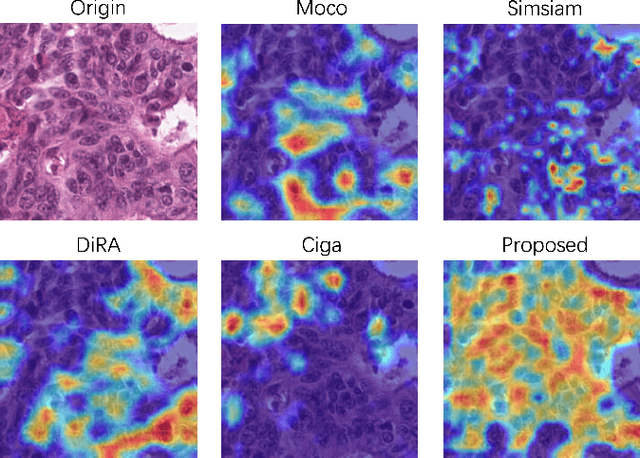 Figure 4 for Nucleus-aware Self-supervised Pretraining Using Unpaired Image-to-image Translation for Histopathology Images