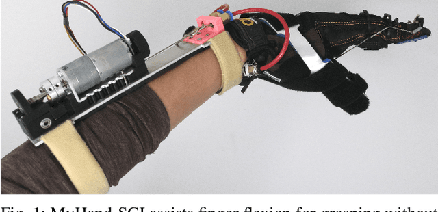 Figure 1 for Towards Tenodesis-Modulated Control of an Assistive Hand Exoskeleton for SCI