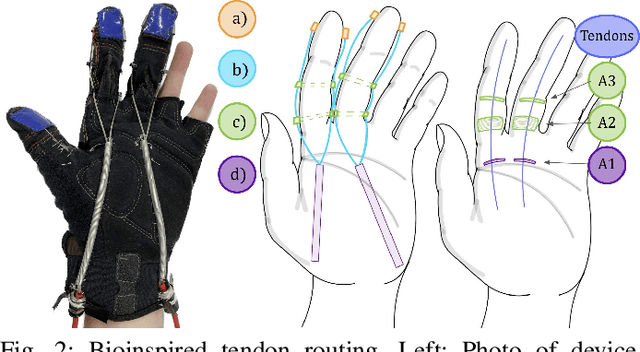 Figure 2 for Towards Tenodesis-Modulated Control of an Assistive Hand Exoskeleton for SCI