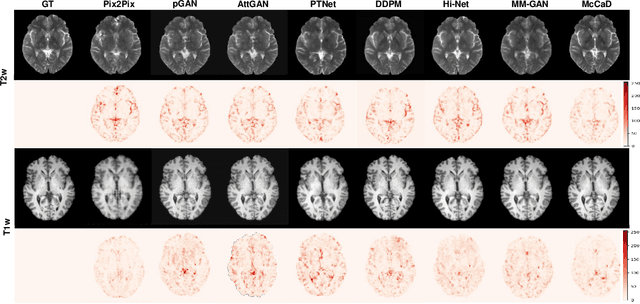 Figure 3 for McCaD: Multi-Contrast MRI Conditioned, Adaptive Adversarial Diffusion Model for High-Fidelity MRI Synthesis